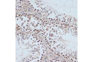 Immunohistochemistry of paraffin-embedded mouse testis using Phospho-BRC-S1423 antibody (ABIN3019880, ABIN3019881, ABIN3019882 and ABIN6225497) at dilution of 1:100 (40x lens).