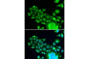 Immunofluorescence analysis of HeLa cells using FZR1 antibody (ABIN6130399, ABIN6140852, ABIN6140854 and ABIN6221196).