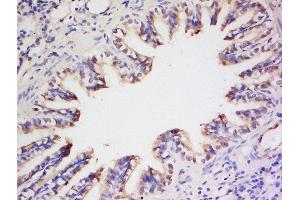 Formalin-fixed and paraffin embedded rat lung labeled with Anti- Preproendothelin 1 Polyclonal Antibody, Unconjugated  at 1:200 followed by conjugation to the secondary antibody and DAB staining (Prepro-Endothelin-1 (AA 16-110) antibody)