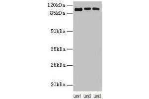 Western blot All lanes: ZNF546 antibody at 4 μg/mL Lane 1: A549 whole cell lysate Lane 2: 293T whole cell lysate Lane 3: Hela whole cell lysate Secondary Goat polyclonal to rabbit IgG at 1/10000 dilution Predicted band size: 99 kDa Observed band size: 99 kDa (ZNF546 antibody  (AA 1-300))
