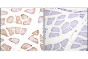 Immunohistochemistry analysis of paraffin-embedded human skeletal muscle tissue, using Akt (Ab-129) Antibody.