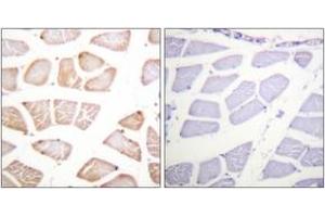 Immunohistochemistry analysis of paraffin-embedded human skeletal muscle tissue, using Akt (Ab-129) Antibody. (AKT1 antibody  (AA 95-144))