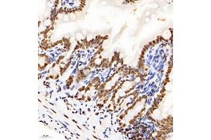 Immunohistochemistry analysis of paraffin-embedded mouse ileum using HNRNPM (ABIN7074247) at dilution of 1: 4000 (HnRNP M1-M4 antibody)