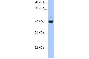 WB Suggested Anti-FGFR1OP Antibody Titration: 0. (FGFR1OP antibody  (N-Term))