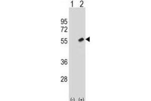 Western Blotting (WB) image for anti-Retinoblastoma Binding Protein 7 (RBBP7) antibody (ABIN2998665) (RBBP7 antibody)