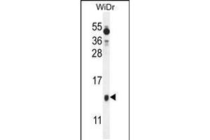 Western blot analysis in WiDr cell line lysates (35ug/lane). (BEX1 antibody  (AA 63-90))