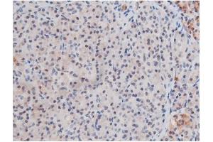 ABIN6267503 at 1/200 staining Human pancreas tissue sections by IHC-P.