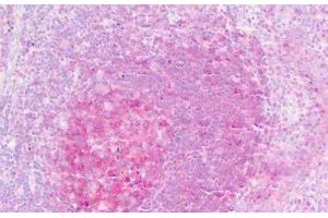 Human Tonsil, Germinal Center: Formalin-Fixed, Paraffin-Embedded (FFPE) (IL1RL2 antibody  (AA 257-286))