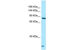 Western Blotting (WB) image for anti-Thyroid adenoma-associated protein (THADA) (C-Term) antibody (ABIN2789989) (THADA antibody  (C-Term))