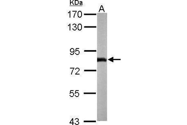 NDUFS1 antibody  (Center)