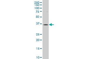 ALS2CR7 polyclonal antibody (A01), Lot # 051130JCO1 Western Blot analysis of ALS2CR7 expression in PC-12 . (Cyclin-Dependent Kinase 15 (ALS2CR7) (AA 242-347) antibody)