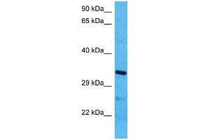 Host:  Mouse  Target Name:  MBD3  Sample Tissue:  Mouse Brain  Antibody Dilution:  1ug/ml (MBD3 antibody  (N-Term))