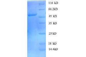 rho GDP Dissociation Inhibitor (GDI) alpha (ARHGDIA) (AA 2-204), (full length) protein (GST tag)