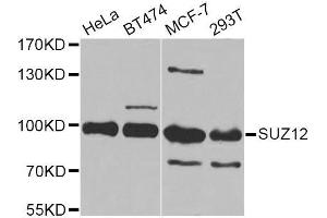 Western blot analysis of extracts of various cell lines, using SUZ12 Antibody (ABIN5975314) at 1/1000 dilution. (SUZ12 antibody)