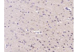 Paraformaldehyde-fixed, paraffin embedded Rat Brian Antigen retrieval by boiling in sodium citrate buffer (pH6. (HSP90AB1 antibody  (AA 635-724))