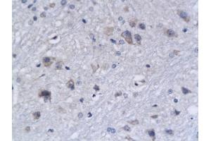 Formalin-fixed and paraffin embedded rat brain tissue labeled with Anti-Bak Polyclonal Antibody, Unconjugated (ABIN674409) followed by conjugation to the secondary antibody and DAB staining (BAK1 antibody  (AA 21-120))