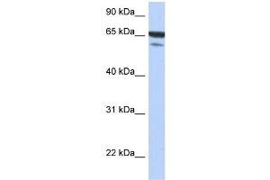 WB Suggested Anti-MAP3K7IP1 Antibody Titration: 0.
