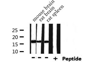 Western blot analysis of UBE2D2 expression in various lysates (UBE2D2 antibody  (C-Term))