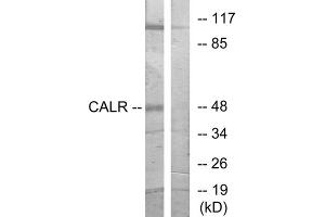 Western blot analysis of extracts from COS-7 cells, using CALR antibody. (Calreticulin antibody  (N-Term))