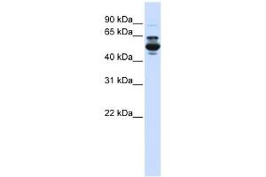 CYP3A43 antibody used at 1 ug/ml to detect target protein. (CYP3A4 antibody  (C-Term))