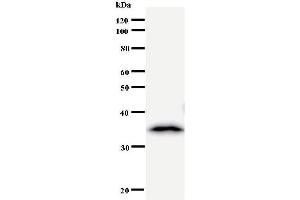 Western Blotting (WB) image for anti-Mediator Complex Subunit 17 (MED17) antibody (ABIN931011) (MED17 antibody)