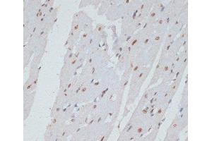 Immunohistochemistry (Paraffin-embedded Sections) (IHC (p)) image for anti-Mitogen-Activated Protein Kinase 3 (MAPK3) (pThr185), (pThr202), (pTyr187), (pTyr204) antibody (ABIN7265214)