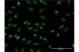 Immunofluorescence of monoclonal antibody to TBL1XR1 on HeLa cell.