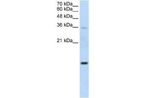 UBE2D2 antibody used at 1. (UBE2D2 antibody)