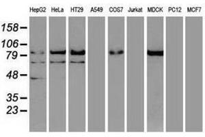 Image no. 1 for anti-Catenin (Cadherin-Associated Protein), beta 1, 88kDa (CTNNB1) (AA 531-781) antibody (ABIN1496900) (CTNNB1 antibody  (AA 531-781))