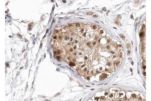 ABIN6267694 at 1/100 staining human testis tissue sections by IHC-P. (HDAC6 antibody  (pSer22))