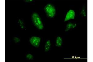 Immunofluorescence of monoclonal antibody to GCM1 on HeLa cell. (GCM1 antibody  (AA 108-166))