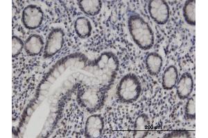 Immunoperoxidase of monoclonal antibody to ZNF138 on formalin-fixed paraffin-embedded human small Intestine. (ZNF138 antibody  (AA 151-251))