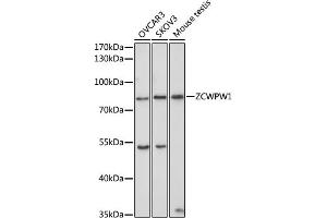 Western blot analysis of extracts of various cell lines, using ZCWPW1 antibody (ABIN6133087, ABIN6150412, ABIN6150413 and ABIN6223508) at 1:1000 dilution. (ZCWPW1 antibody  (AA 389-648))
