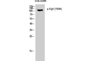 Western Blotting (WB) image for anti-Kinesin Family Member 11 (KIF11) (pThr926) antibody (ABIN5961163) (KIF11 antibody  (pThr926))