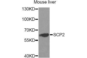 Western blot analysis of extracts of mouse liver, using SCP2 Antibody. (SCP2 antibody)