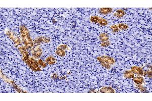 Immunohistochemistry (IHC) image for anti-Keratin 5 (KRT5) (AA 335-473) antibody (ABIN7437212)