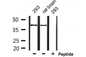 Western blot analysis of extracts from 293 and rat brain, using RNF130 Antibody. (RNF130 antibody  (Internal Region))