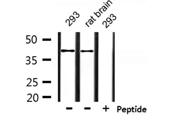 RNF130 antibody  (Internal Region)