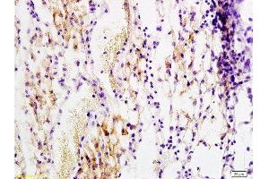 Formalin-fixed and paraffin embedded rat transplant lymphoma labeled with Anti-PDGF-B Polyclonal Antibody, Unconjugated  at 1:200 followed by conjugation to the secondary antibody and DAB staining