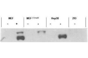 Western Blotting (WB) image for anti-SMAD, Mothers Against DPP Homolog 3 (SMAD3) (pSer423), (pSer425) antibody (ABIN129675)