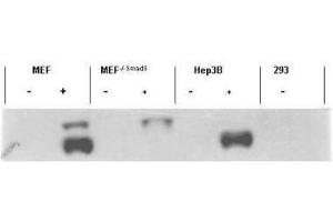 Western blot using  affinity purified anti-Smad3 pS423 pS425 antibody shows detection of endogenous Smad3 in stimulated cell lysates. (SMAD3 antibody  (pSer423, pSer425))