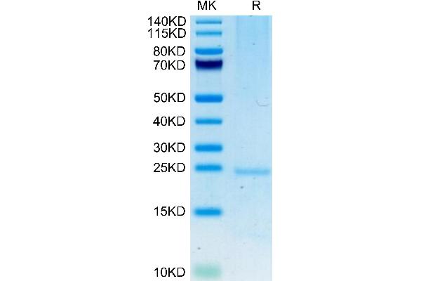 FGF7 Protein (AA 32-194) (His tag)