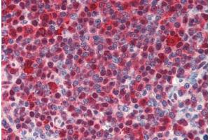 Human Spleen (formalin-fixed, paraffin-embedded) stained with HSPA8 antibody ABIN462103 at 10 ug/ml followed by biotinylated secondary antibody, alkaline phosphatase-streptavidin and chromogen. (Hsc70 antibody)