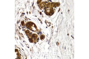 Immunohistochemistry of paraffin-embedded human mammary gland using CTSS antibody.