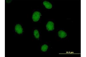 Immunofluorescence of purified MaxPab antibody to SDCCAG10 on HeLa cell. (Cwc27 antibody  (AA 1-291))