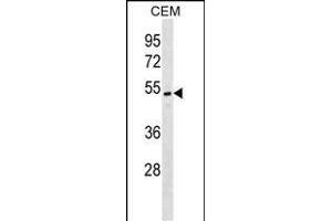 ONECUT2 Antibody (N-term) (ABIN1538931 and ABIN2848980) western blot analysis in CEM cell line lysates (35 μg/lane). (ONECUT2 antibody  (N-Term))