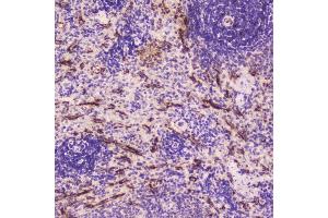 IHC analysis of C Reactive Protein using anti-C Reactive Protein antibody (ABIN5692861).