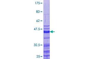 Image no. 1 for Protamine 2 (PRM2) (AA 1-102) protein (GST tag) (ABIN1316324) (PRM2 Protein (AA 1-102) (GST tag))