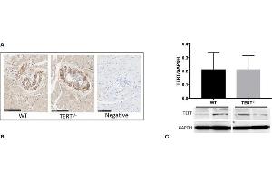 TERT expression and activity assessment in the TERT-/- and WT. (TERT antibody  (AA 601-750))