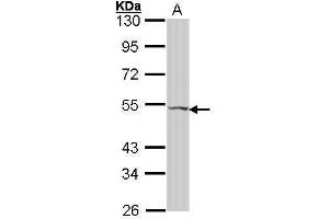WB Image Sample (30 ug of whole cell lysate) A: Hela 10% SDS PAGE antibody diluted at 1:1000 (VIPR2 antibody  (C-Term))